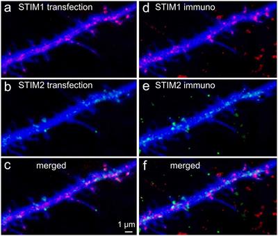 Calcium Sensors STIM1 and STIM2 Regulate Different Calcium Functions in Cultured Hippocampal Neurons